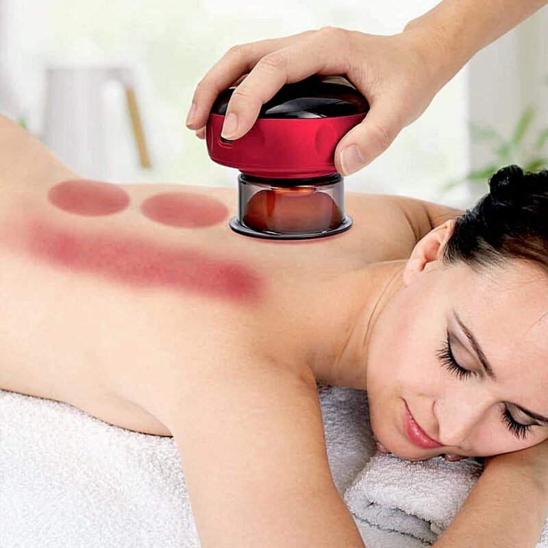 smart cupping massager