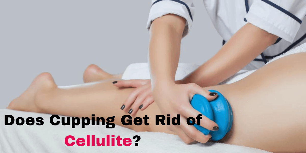 Does Cupping Get Rid of Cellulite