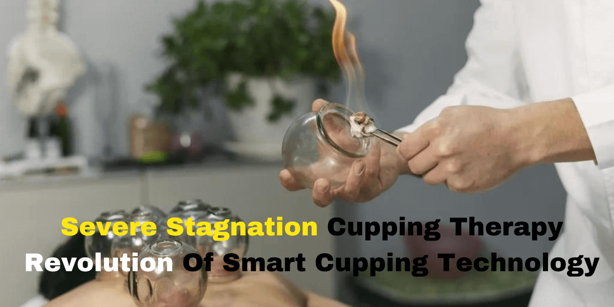 Smart Cupping therapy Massager