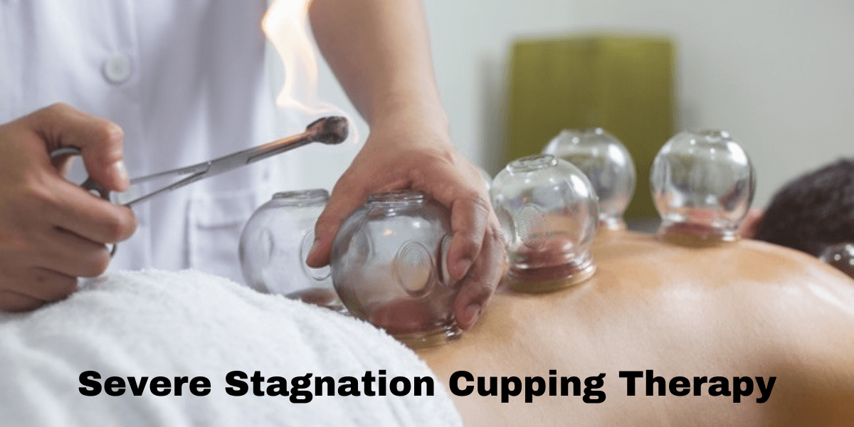 Smart cupping therapy chictmart